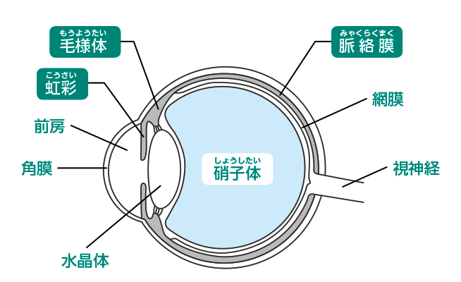 ぶどう膜炎の原因は何ですか?